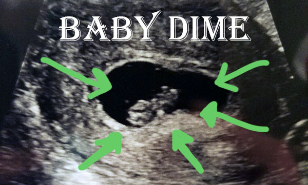 baby dime