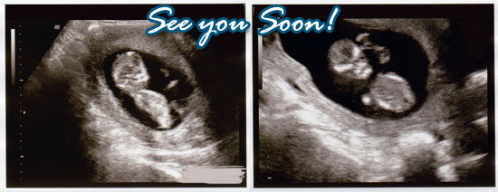 J. Money Baby coming!